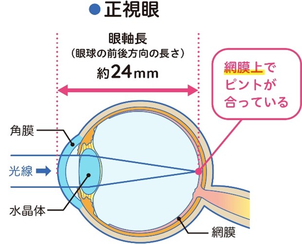 正視眼 正視眼