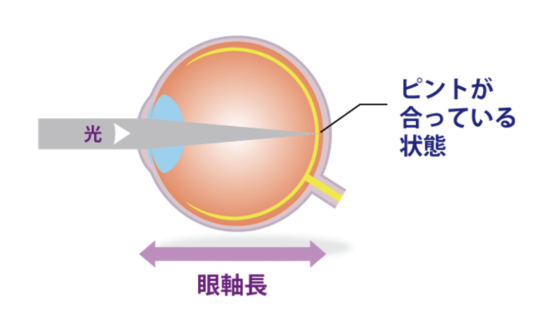 正視眼