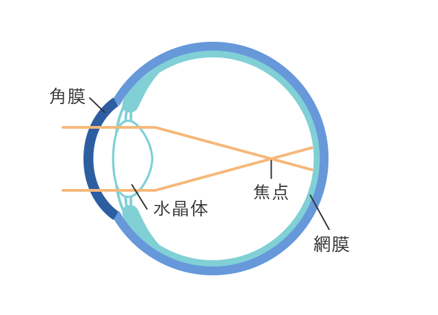 装用前（近視の状態）